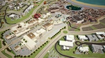 Stones