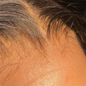Hot Beauty Hd Lace Frontal Preplucked 10a Quality 13x6 Brazilian Virgin Hd Swiss Lace Frontals And Closures Vendor