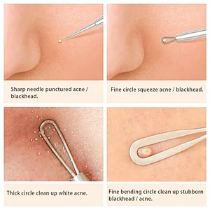 Blackhead Remover Pimple Popper Tool Acne Comedone Zit Extractor Kit Blemish Whitehead Extraction Popping Needle