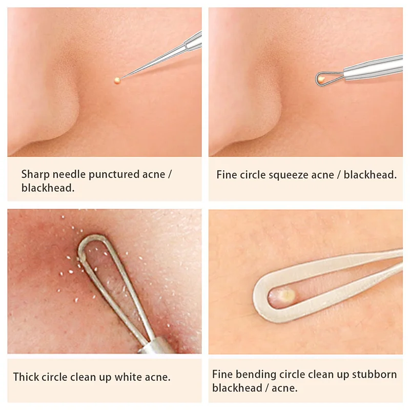 Blackhead Remover Pimple Popper Tool Acne Comedone Zit Extractor Kit Blemish Whitehead Extraction Popping Needle