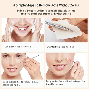 Blackhead Remover Pimple Popper Tool Acne Comedone Zit Extractor Kit Blemish Whitehead Extraction Popping Needle