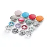 prong snap button