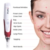 skin care device