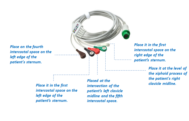 5-lead ECG monitor cable