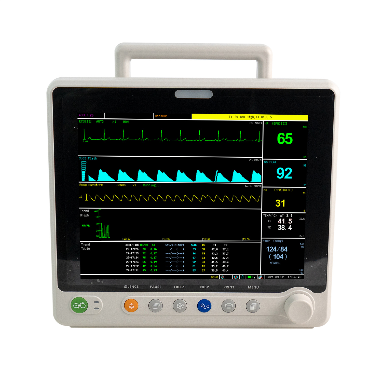 Patient Monitor