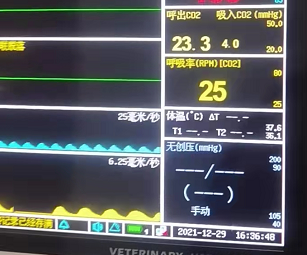 Pulse oximeter,  Patient Monitor, ICU monitor, oximeter, oximetre, utech-news