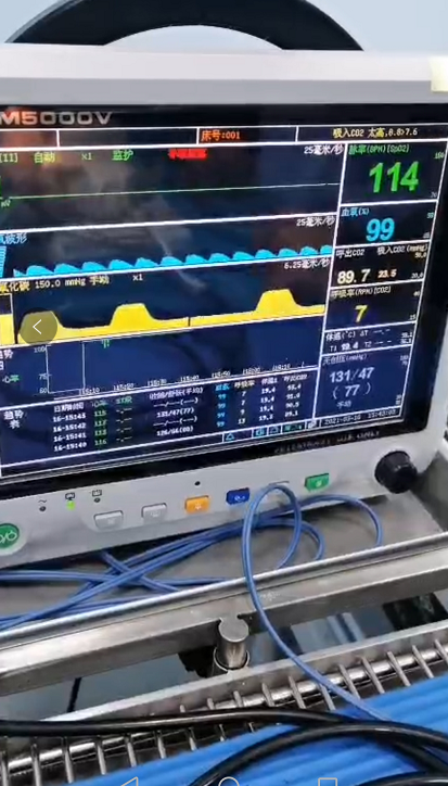 Pulse oximeter,  Patient Monitor, ICU monitor, oximeter, oximetre, utech-news