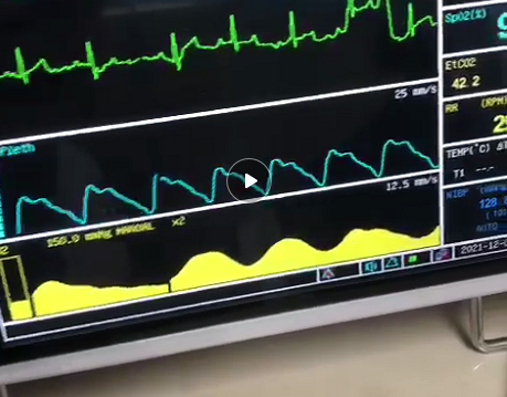 Pulse oximeter,  Patient Monitor, ICU monitor, oximeter, oximetre, utech-news