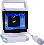 Bladder Scanner
