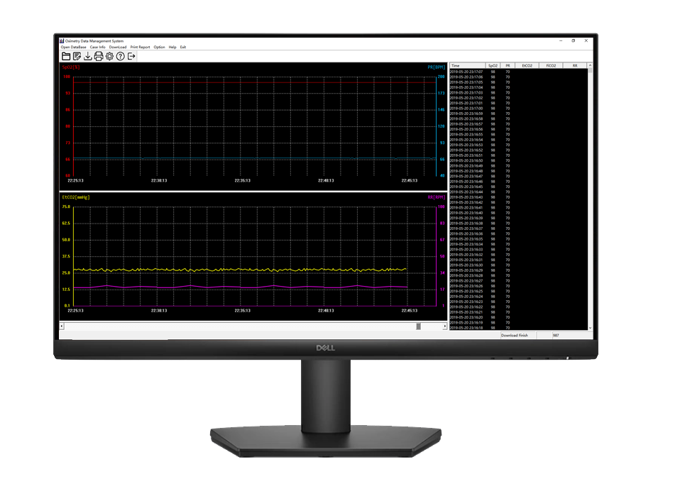 Effortless Data Export & Analysis portable vital signs monitor