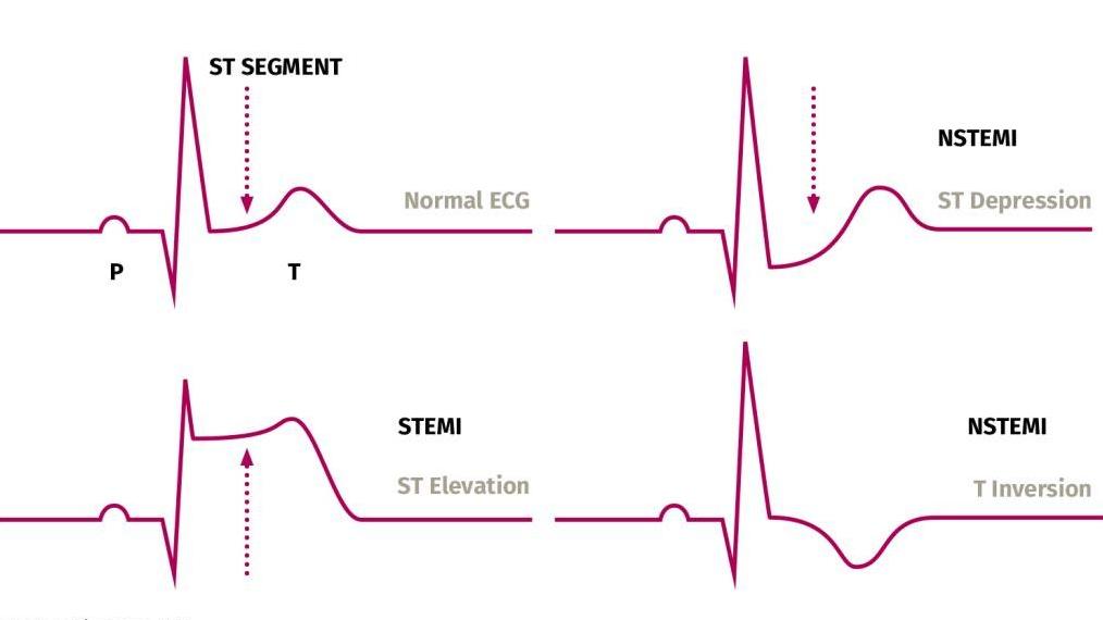 patient monitor