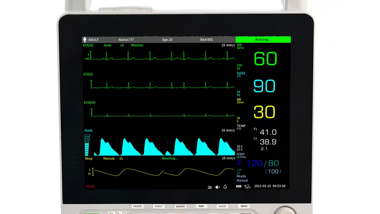 Patient Monitor