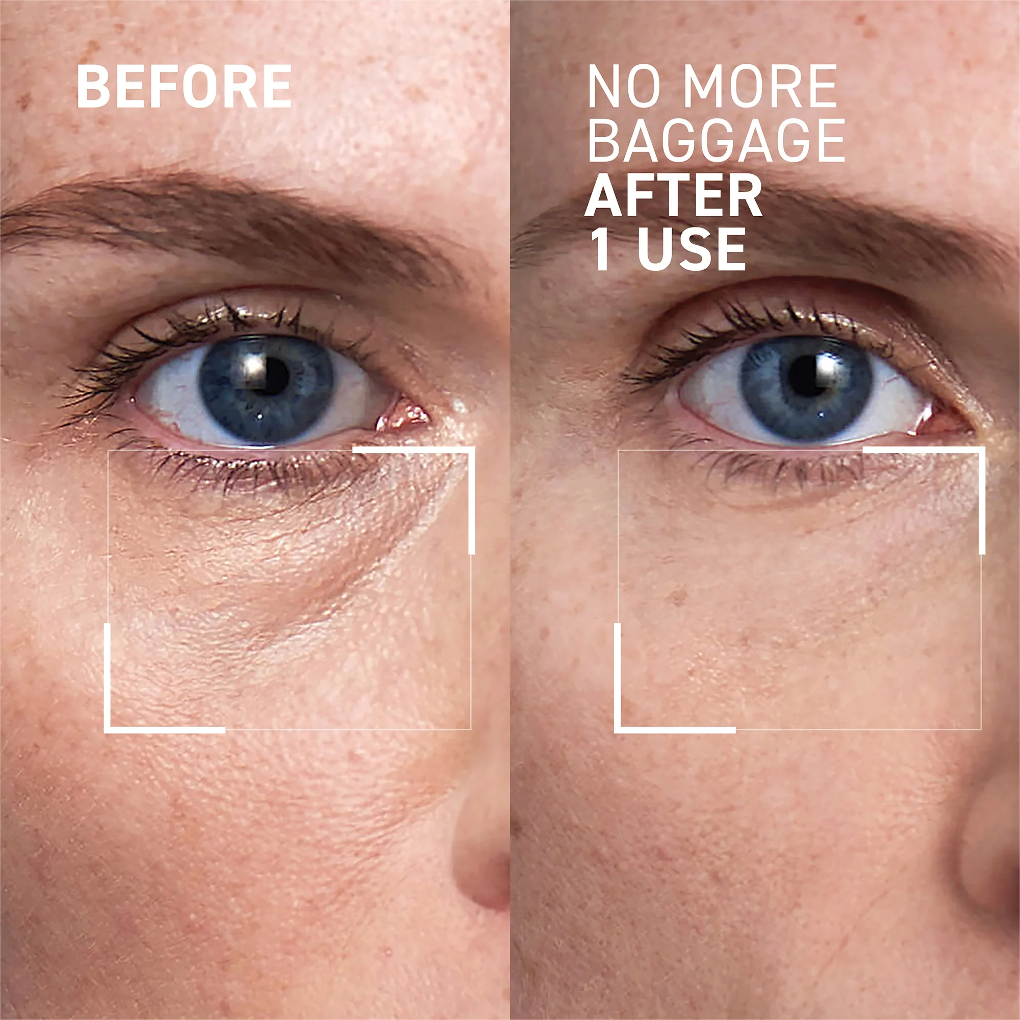 Eye Cream