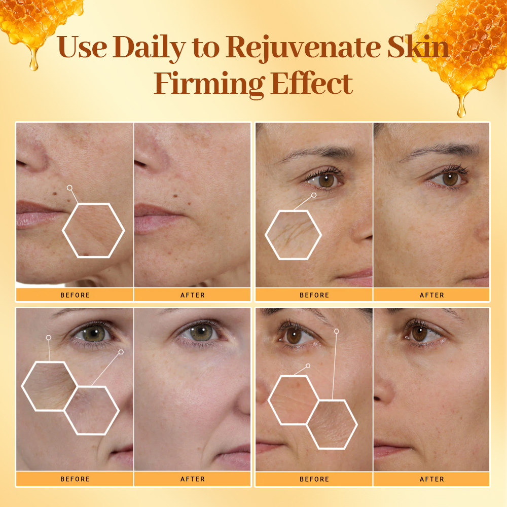 Bee Venom Peptide Skin Care Set