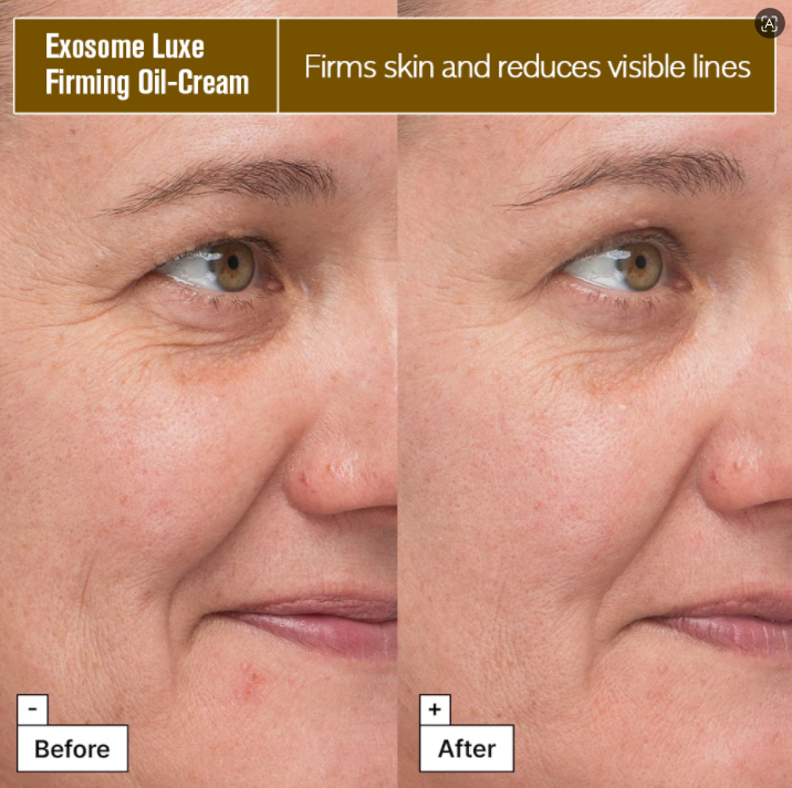 anti aging face cream