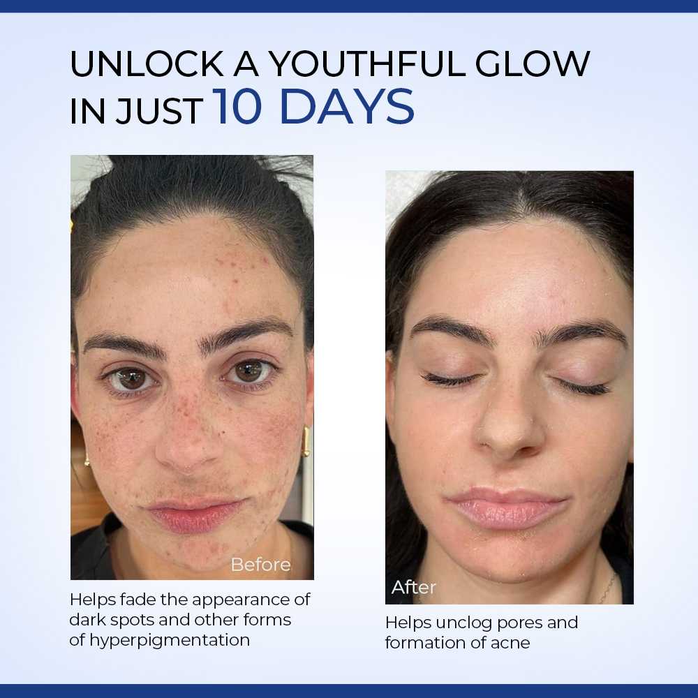 Glycolic Acid Pads
