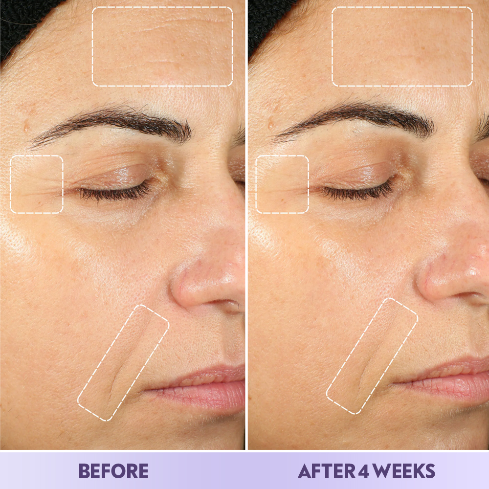Anti Wrinkles Skin Care Set