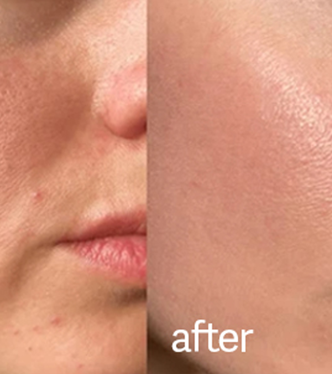 Micromolecular blue-copper peptide Serum