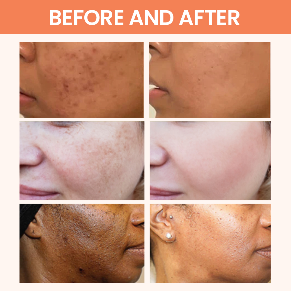 Kojic Acid Oil