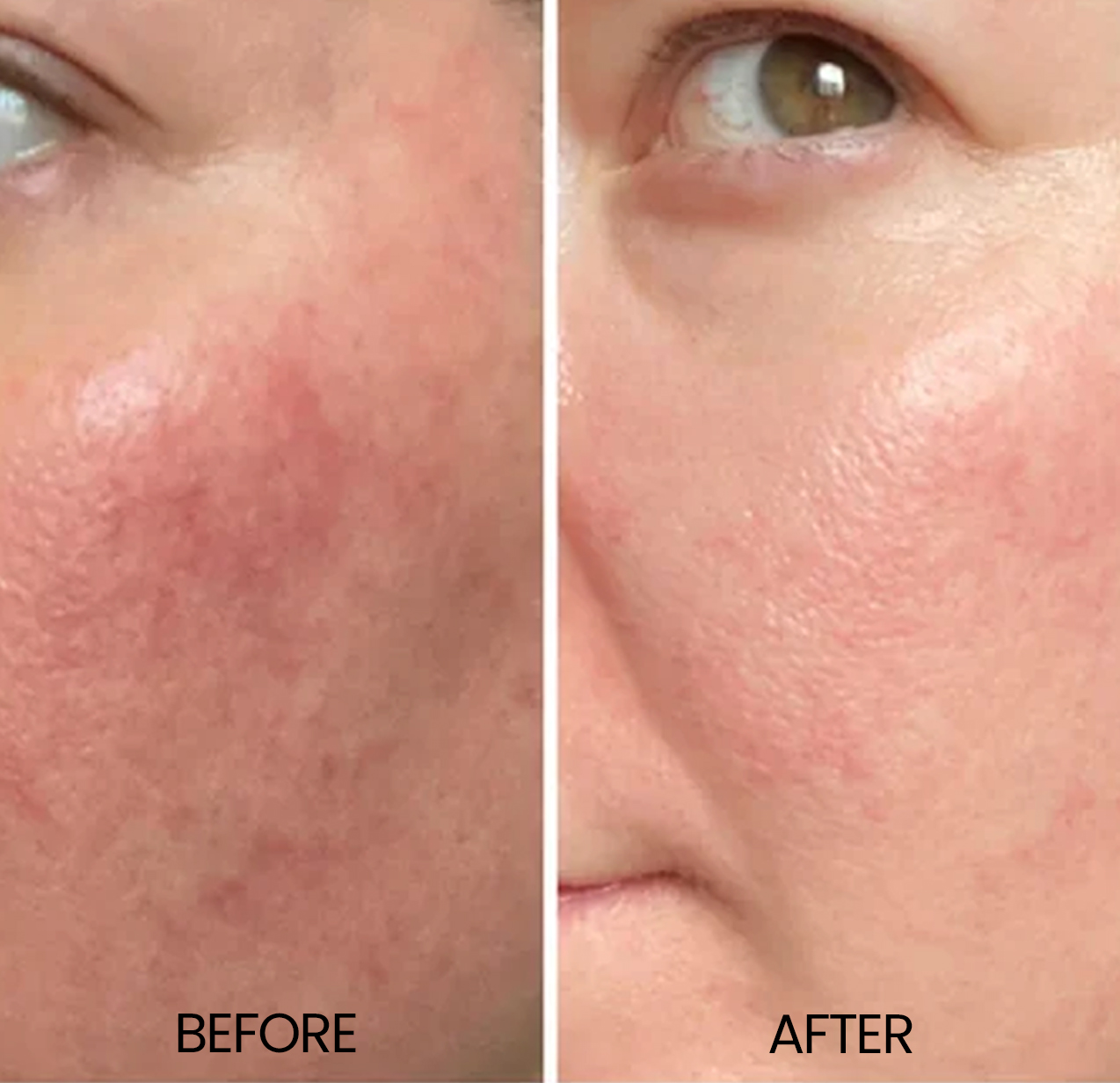 Redness Repairing Skin Care Set