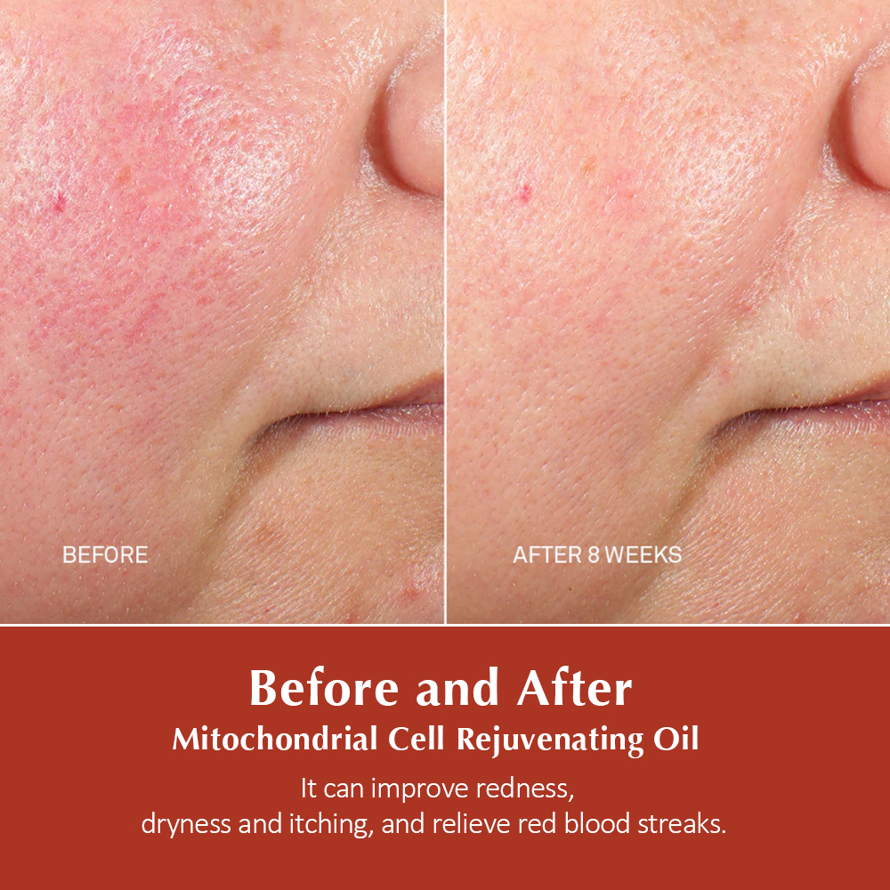 double serum