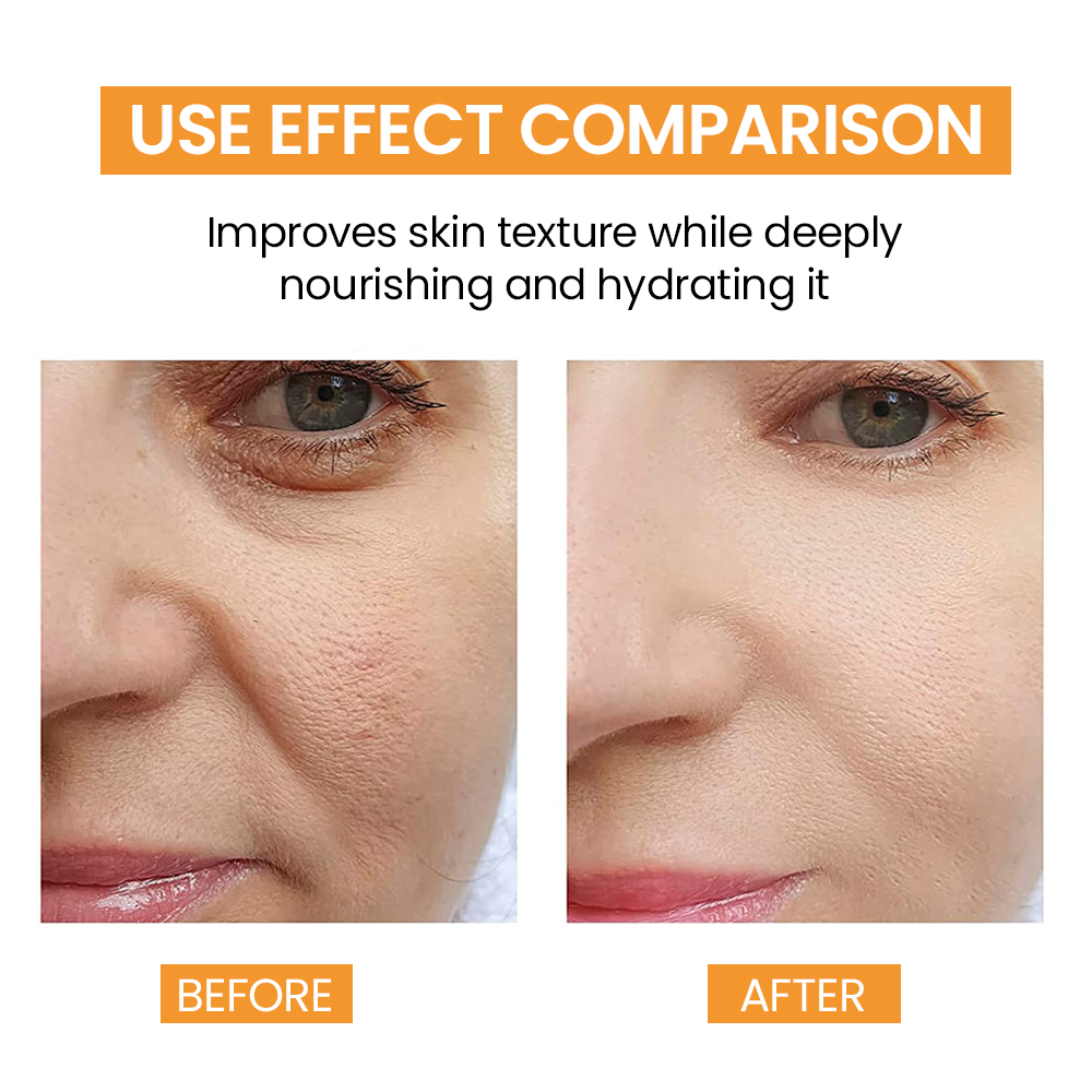 Salicylic Acid Pads