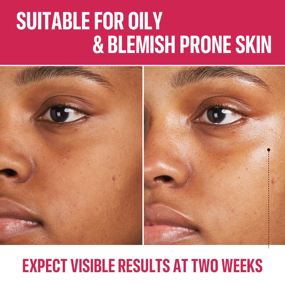 Black Women Brightening Skin Care Set