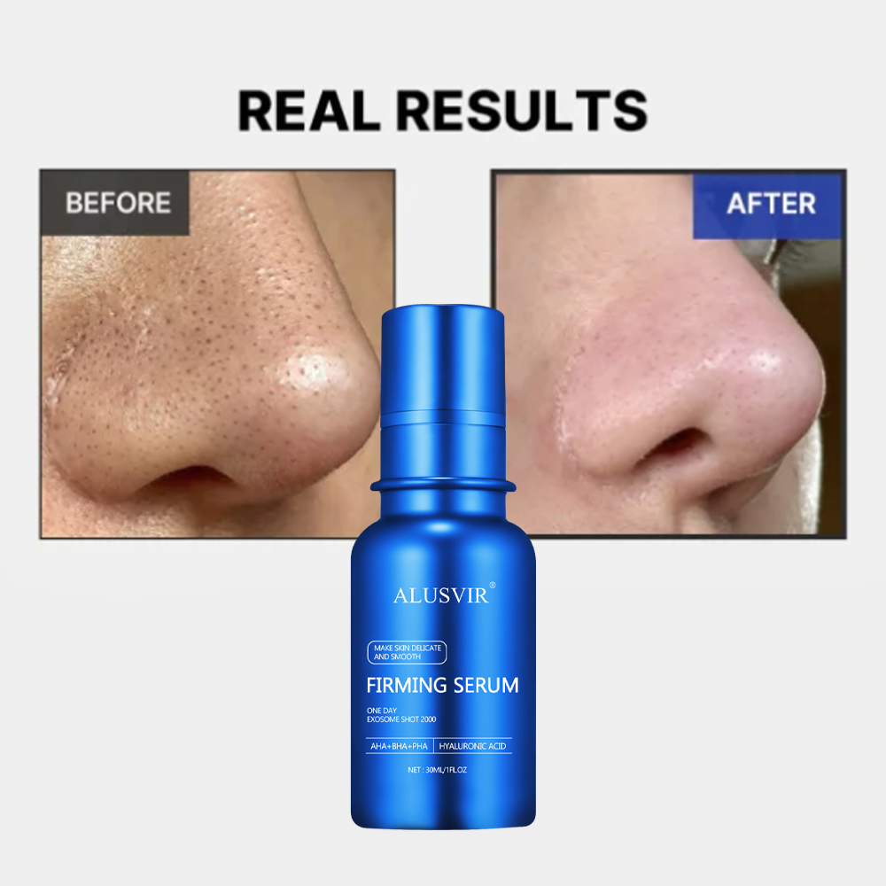 Exosome Serum