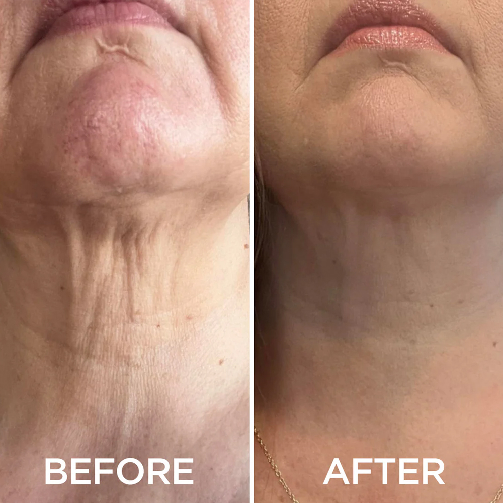 Neck Care Set
