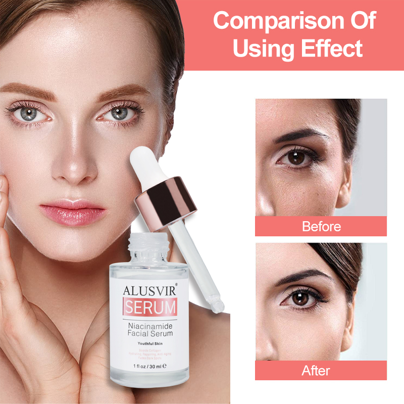 Naicinamide Serum