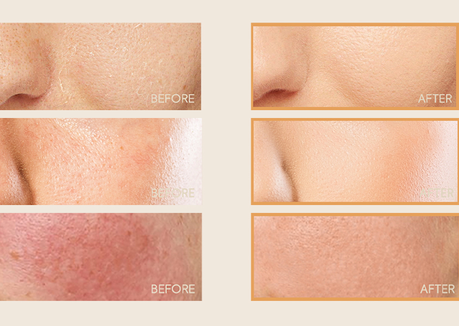 Collagen Eye Cream