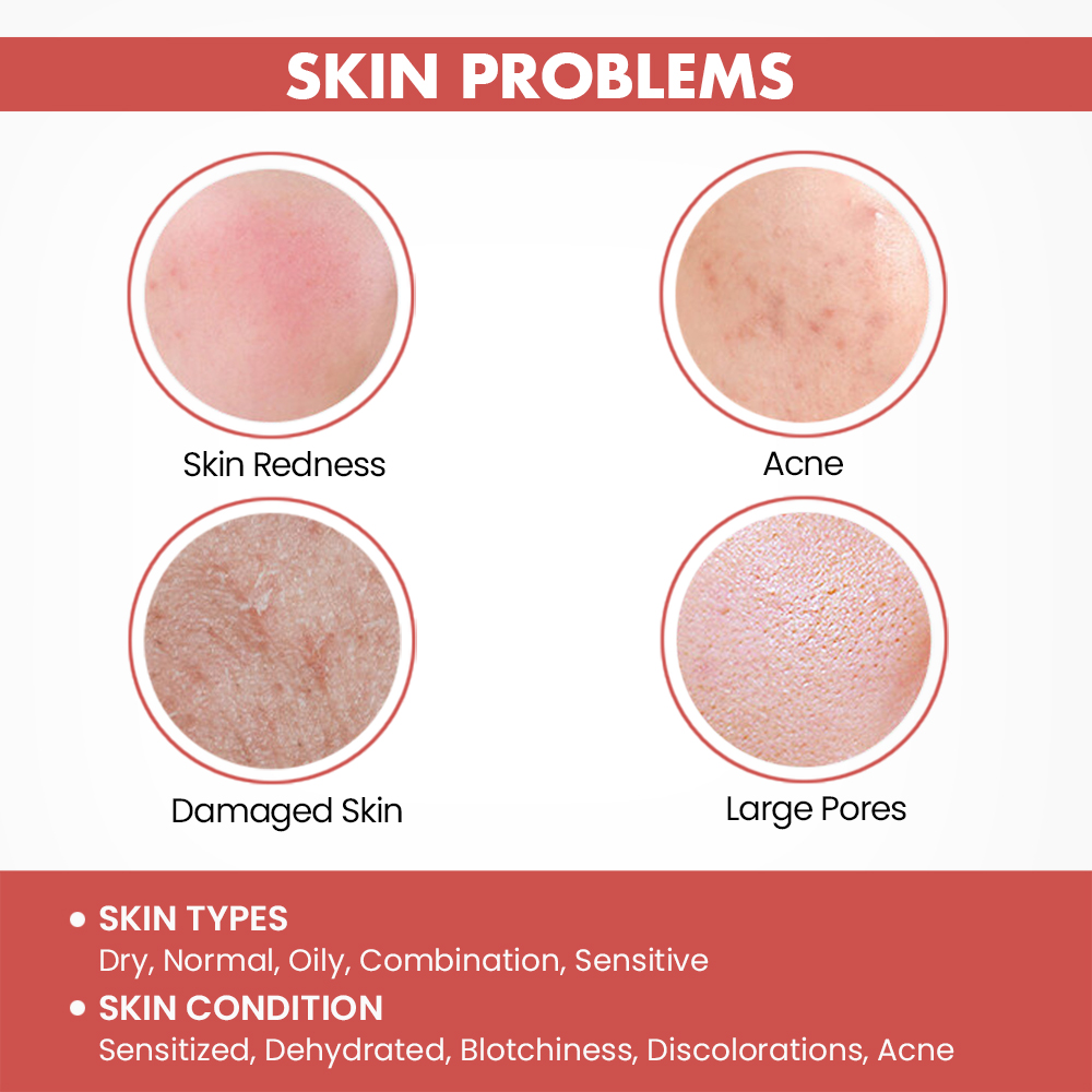 Redness Repairing Skin Care Set