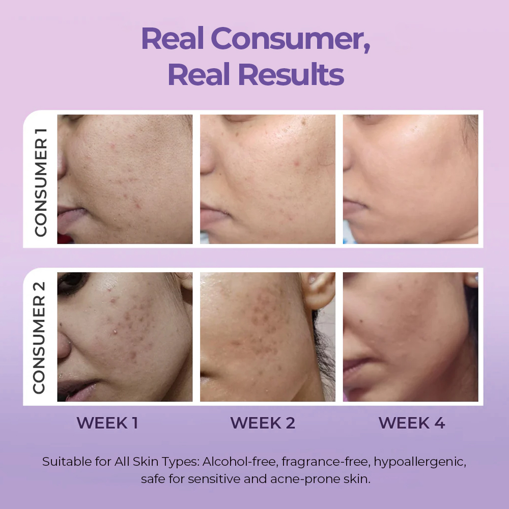 Collagen Mask