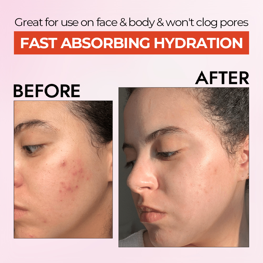 Face & Body Moisturizing Gel
