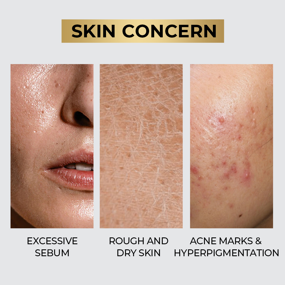 Exosome Skin Care Set