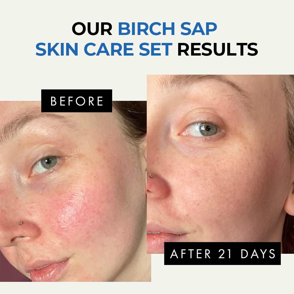 Birch Sap Skin Care Set