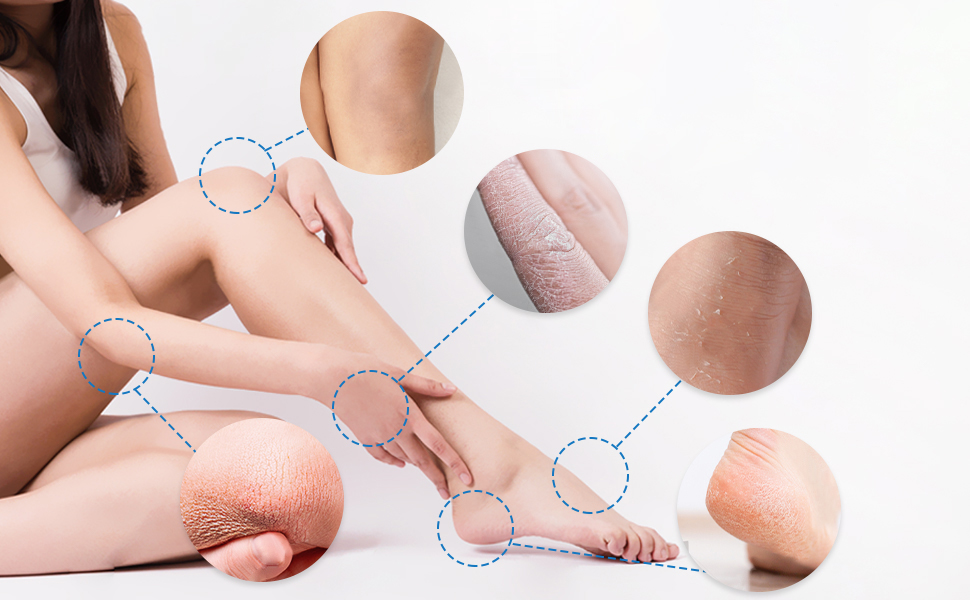 Foot Cream
