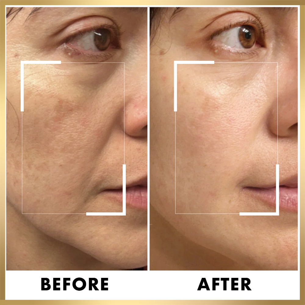 24K Gold Skin Care Set