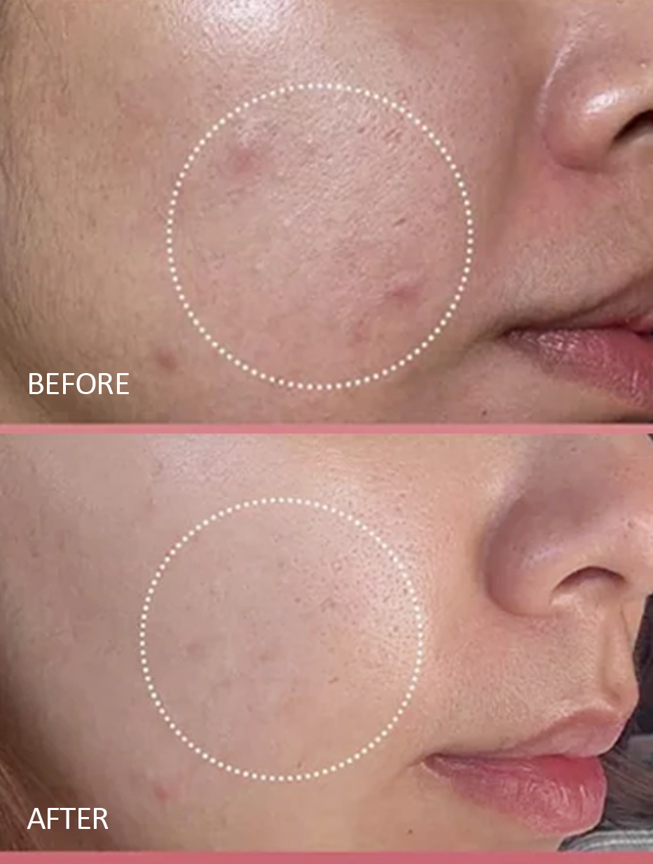 PDRN Mousse Face Cleanser