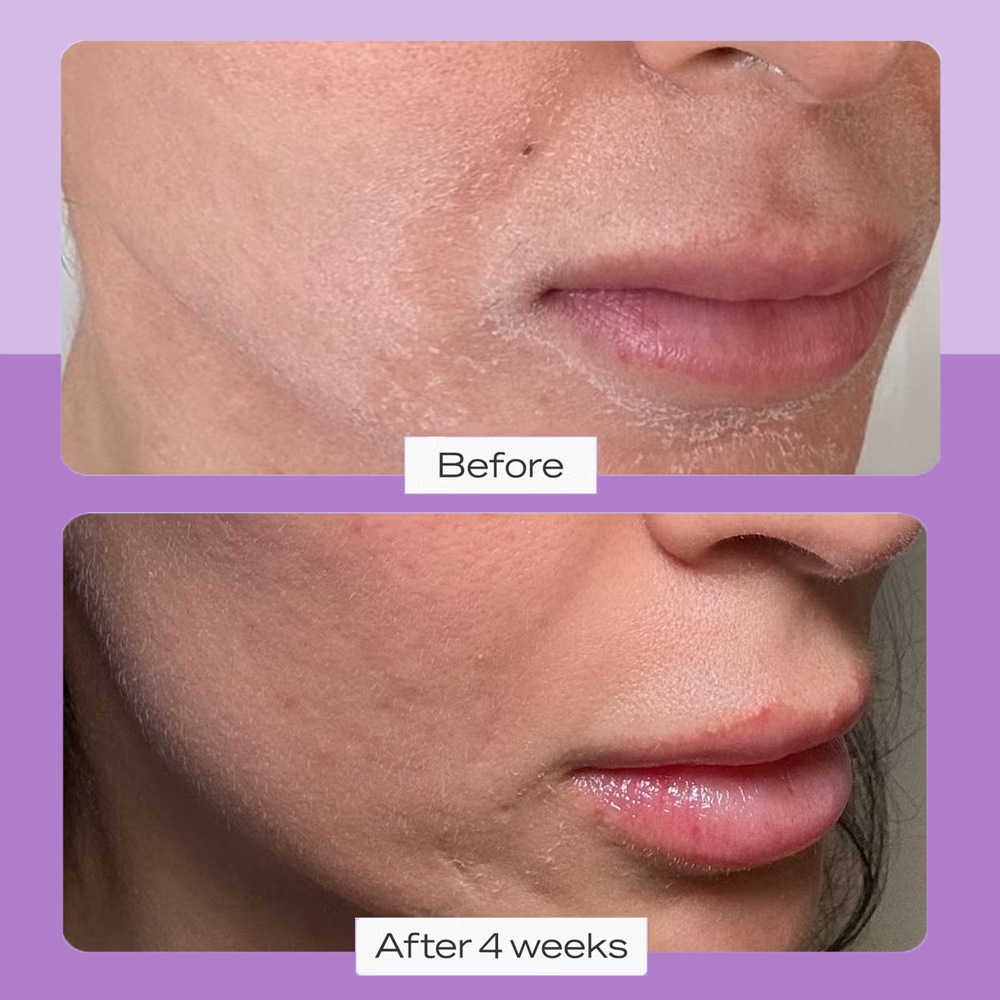 Super Repairing Skin Care Set