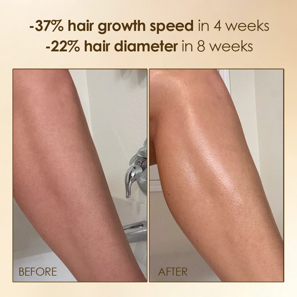 Hair Growth Inhibitor Oil