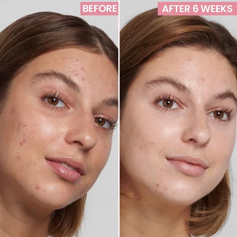 Multi-functional Skin Care Set