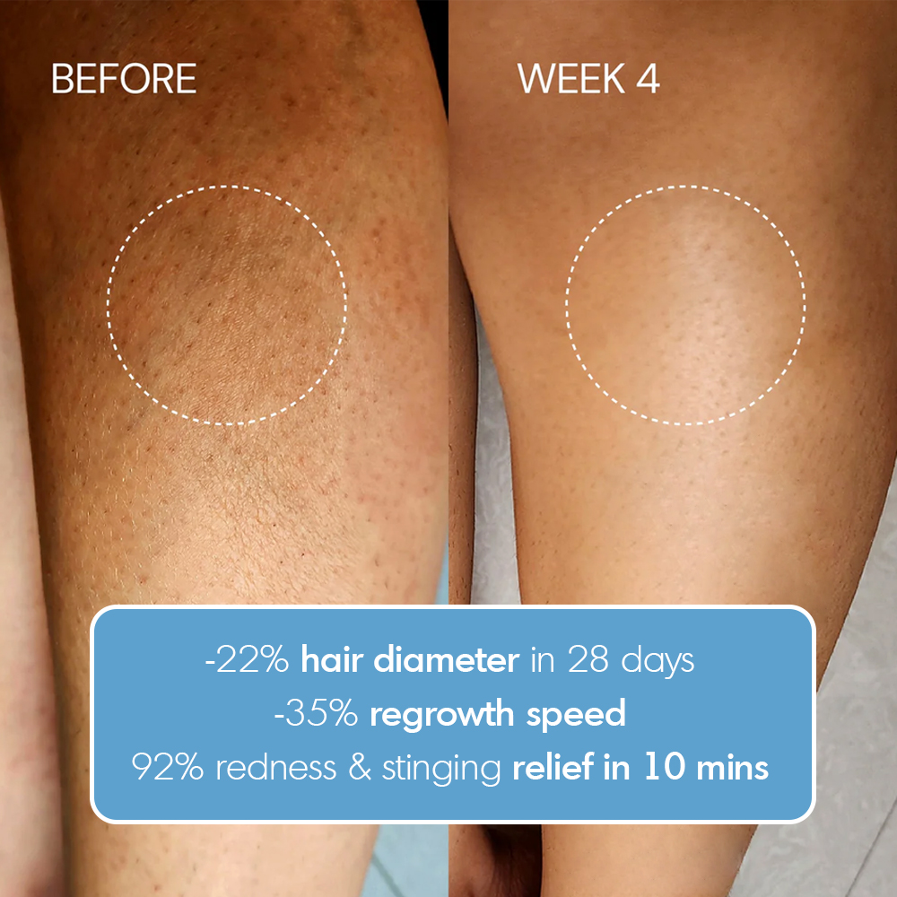 Hair Removal Post-Care Body Lotion
