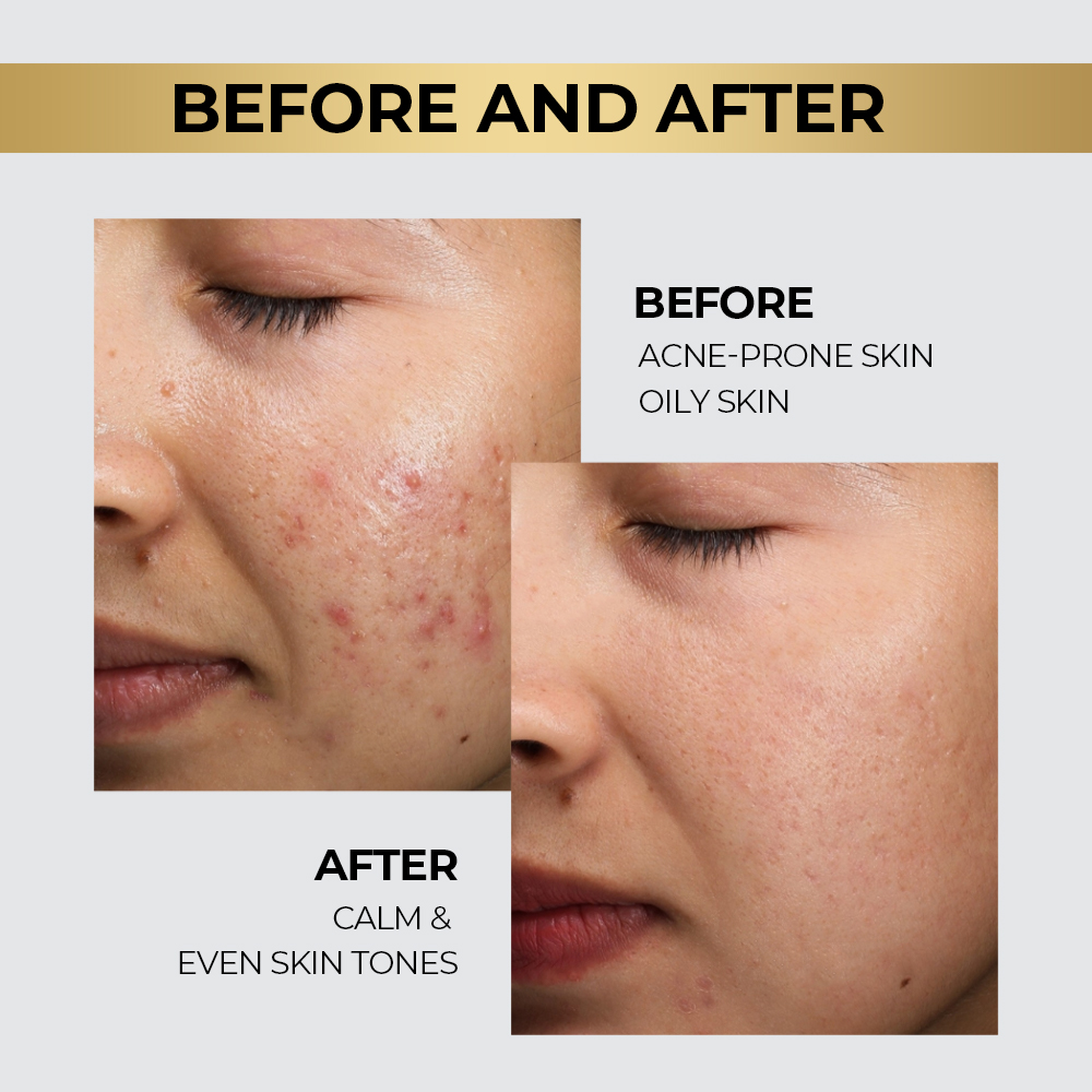 Exosome Skin Care Set