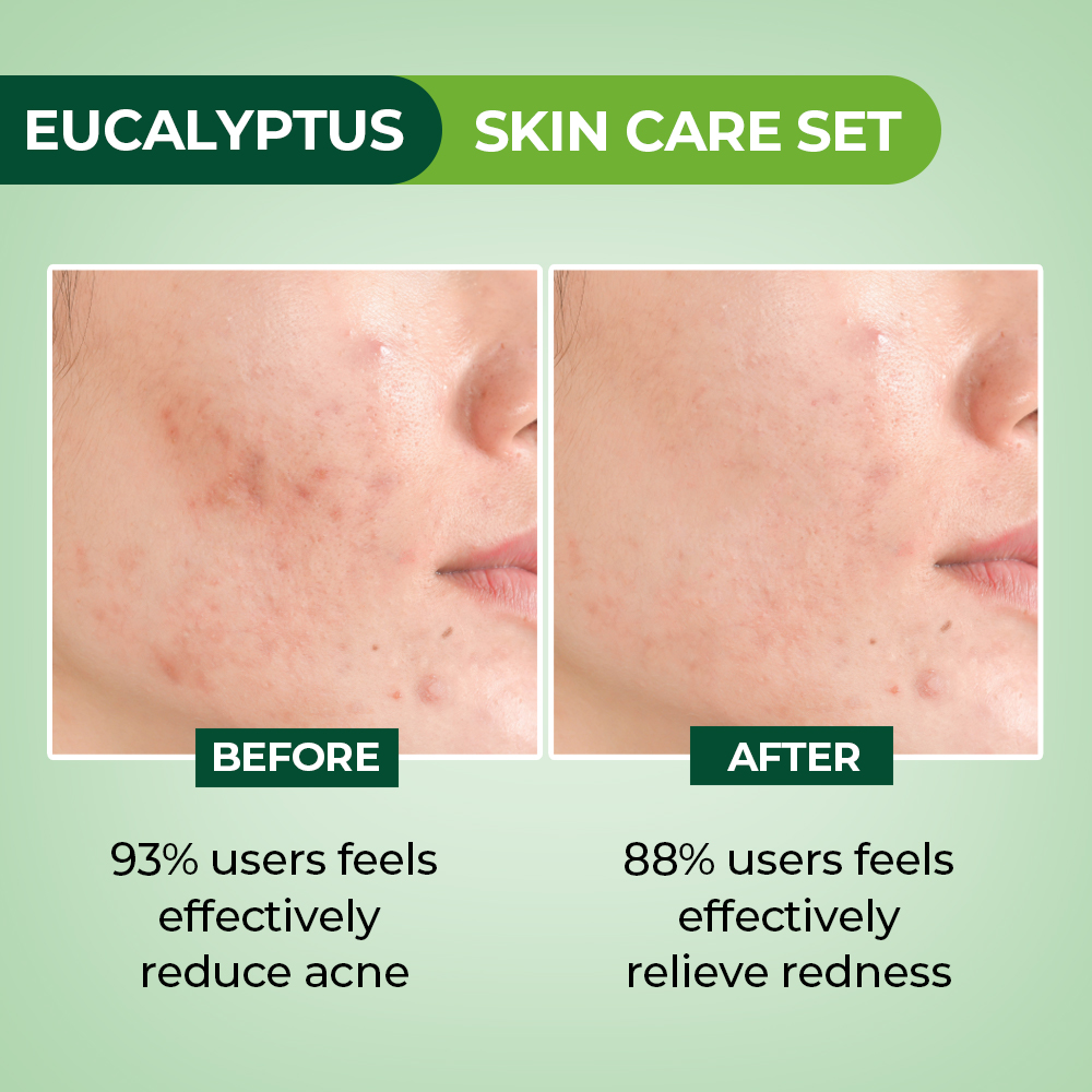 Eucalyptus Skin Care Set