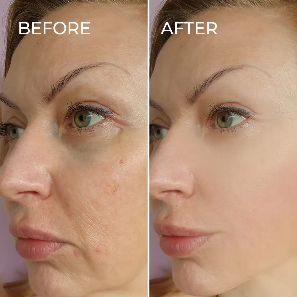 BlackTea Skin Care Set