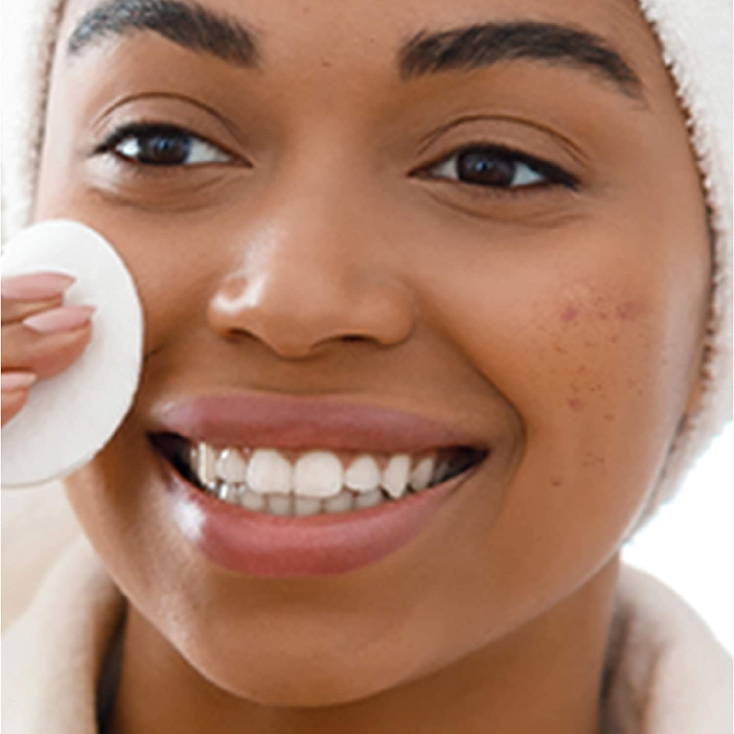 ACNE TREATMENT SKIN CARE SET