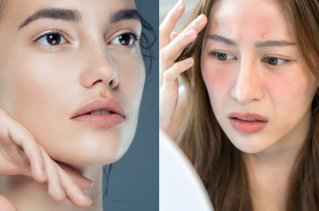 gentle cleanser for sensitive skin