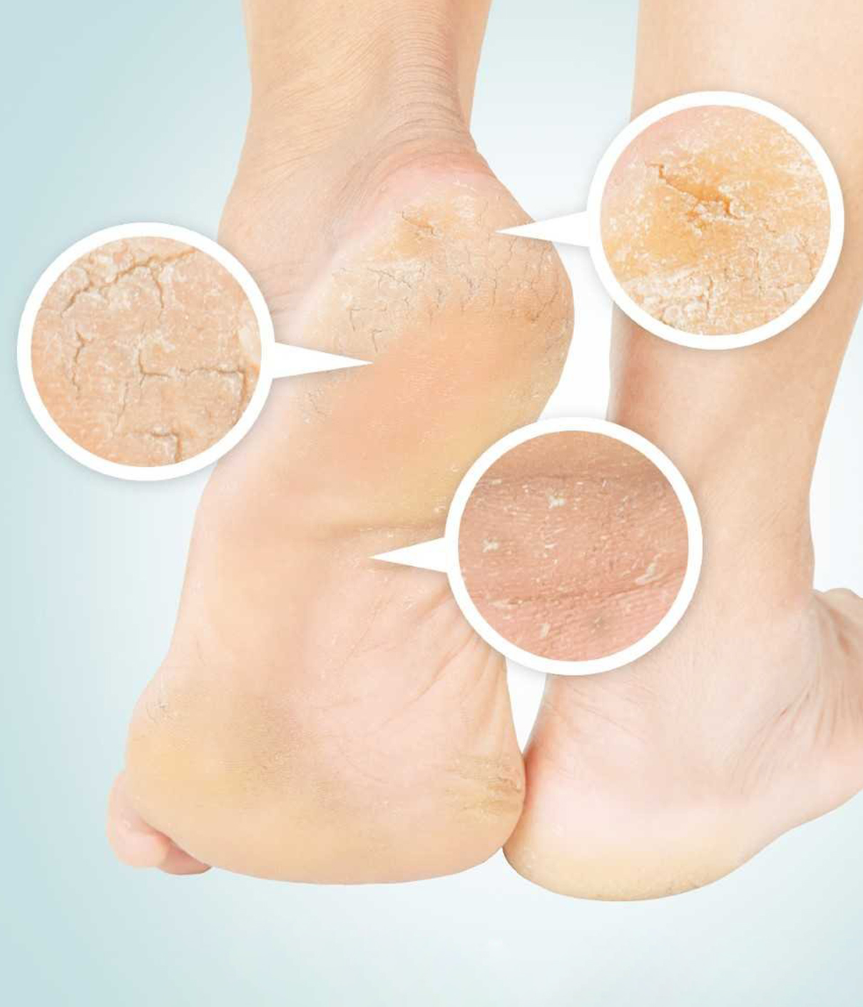 Foot Exfoliating Scrub