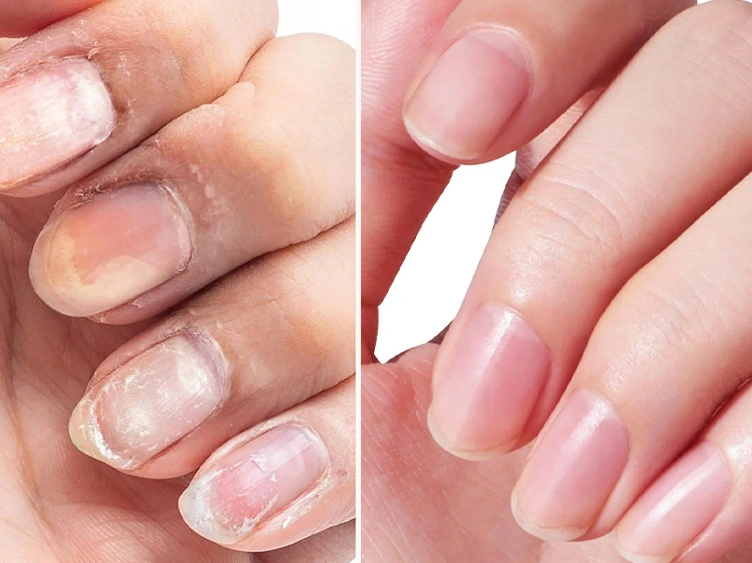 Nail Growth Oil